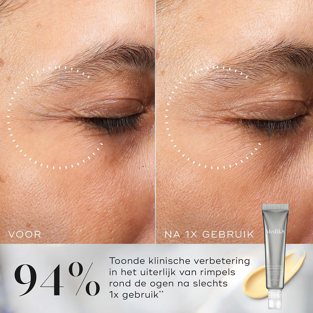 klinisch bewezen nachtcrème voor de ogen bevat retinAL (geen retinol) van de volgende generatie, dat 11 keer sneller werkt dan standaard retinol* en al na 1 keer gebruik opmerkelijke zichtbare resultaten oplevert.
