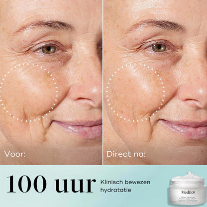 De kracht van deze Total moisture daily facial cream ligt in de hydraterende emoliënten wat de huidbarriere vol en zacht maakt.